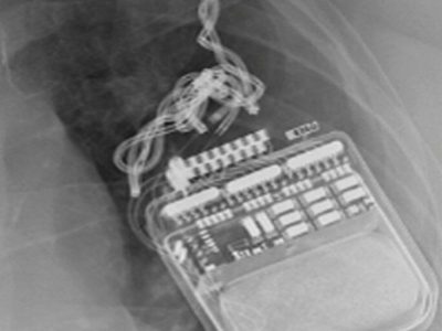 Avoiding and managing surgical complications